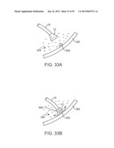 TISSUE VISUALIZATION DEVICE AND METHOD VARIATIONS diagram and image