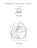 TISSUE VISUALIZATION DEVICE AND METHOD VARIATIONS diagram and image