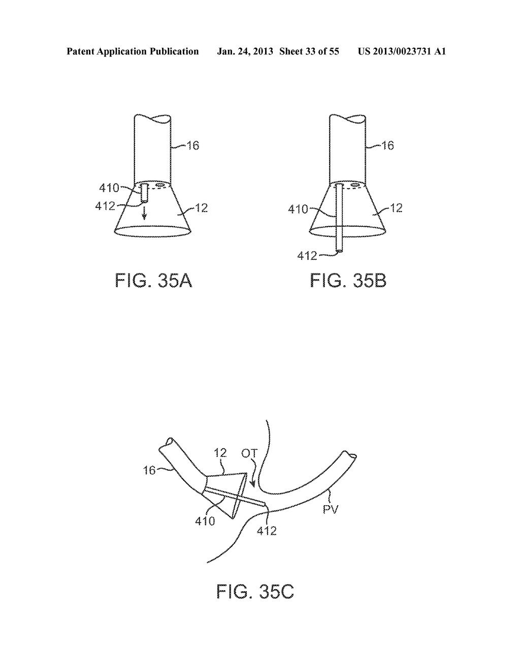 TISSUE VISUALIZATION DEVICE AND METHOD VARIATIONS - diagram, schematic, and image 34