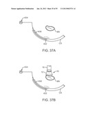 TISSUE VISUALIZATION DEVICE AND METHOD VARIATIONS diagram and image