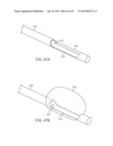 TISSUE VISUALIZATION DEVICE AND METHOD VARIATIONS diagram and image