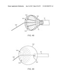 TISSUE VISUALIZATION DEVICE AND METHOD VARIATIONS diagram and image