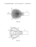 TISSUE VISUALIZATION DEVICE AND METHOD VARIATIONS diagram and image