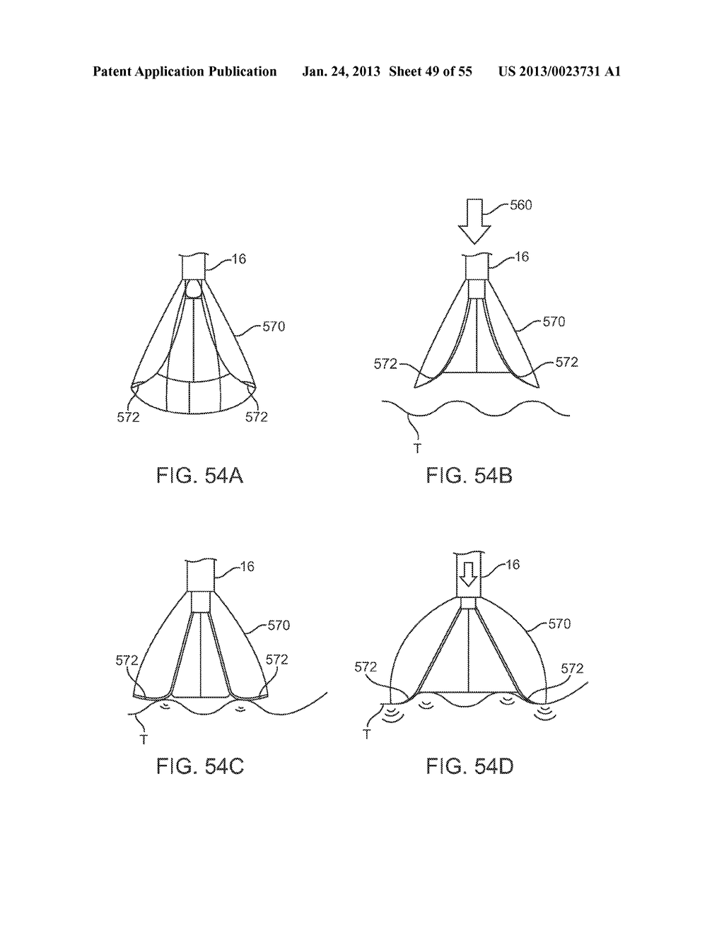 TISSUE VISUALIZATION DEVICE AND METHOD VARIATIONS - diagram, schematic, and image 50