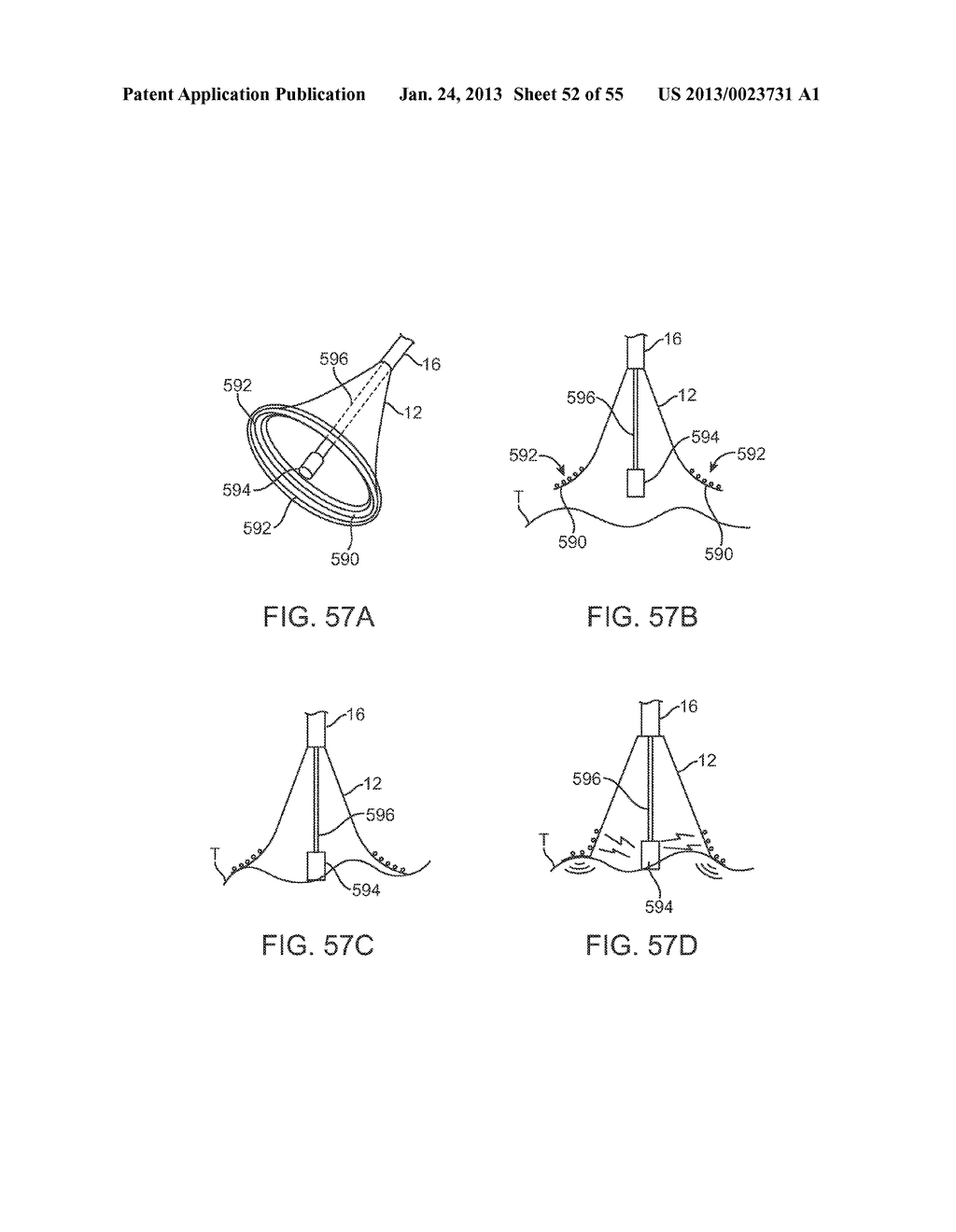 TISSUE VISUALIZATION DEVICE AND METHOD VARIATIONS - diagram, schematic, and image 53