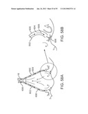 TISSUE VISUALIZATION DEVICE AND METHOD VARIATIONS diagram and image