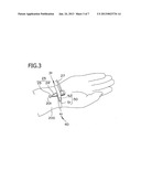 INTRODUCER SHEATH ASSEMBLY AND METHOD diagram and image