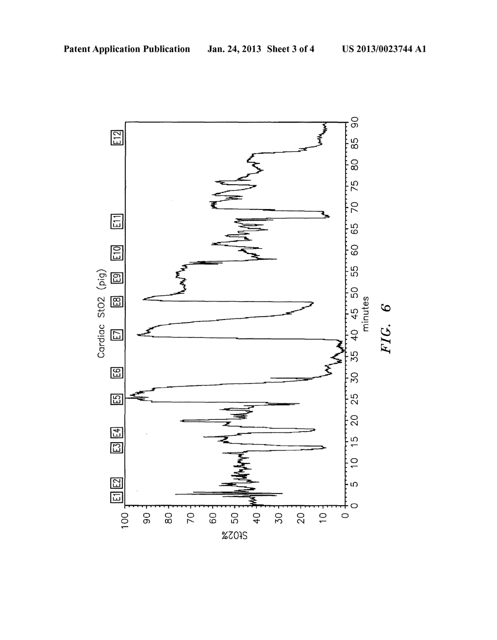 METHOD FOR SPECTROPHOTOMETRIC BLOOD OXYGENATION MONITORING OF ORGANS IN     THE BODY - diagram, schematic, and image 04