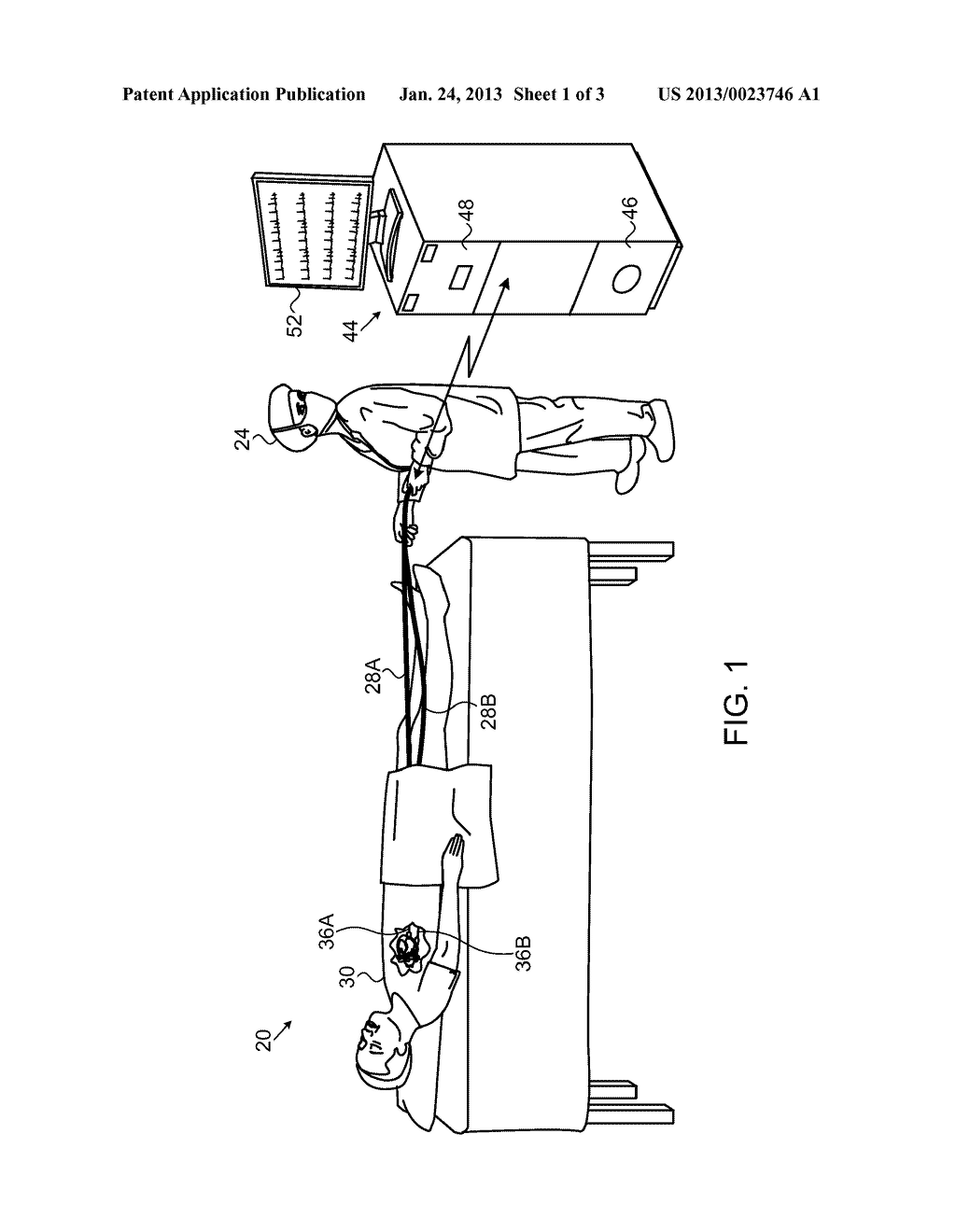 SYNCHRONIZATION OF WIRELESS CATHETERS - diagram, schematic, and image 02