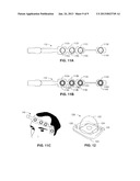 FORCE REGULATING DEVICE APPLICATORS diagram and image