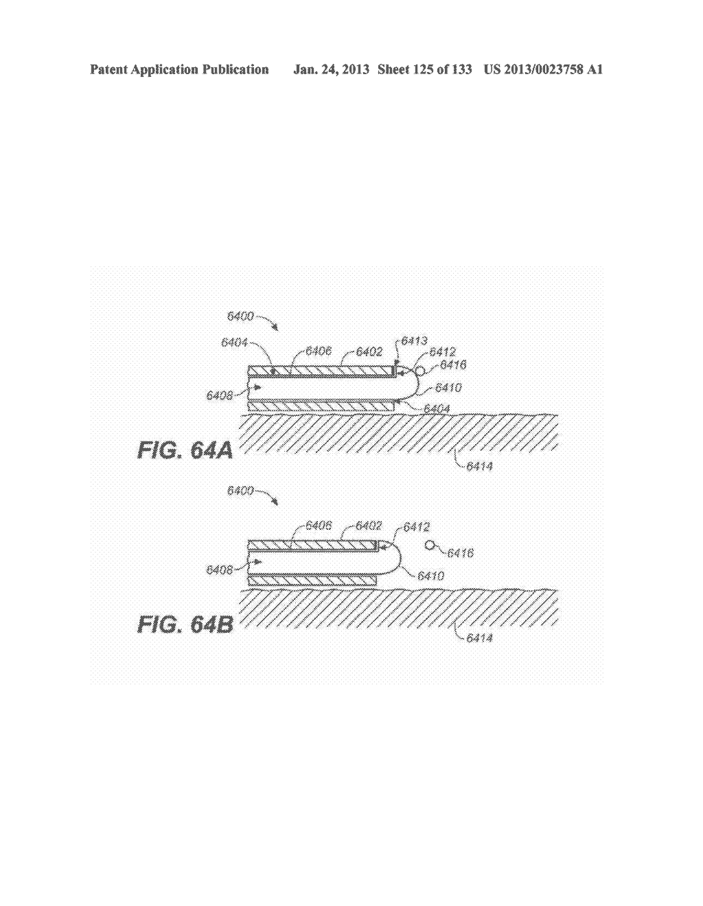 DIAGNOSTIC CATHETERS, GUIDE CATHETERS, VISUALIZATION DEVICES AND CHORD     MANIPULATION DEVICES, AND RELATED KITS AND METHODS - diagram, schematic, and image 126