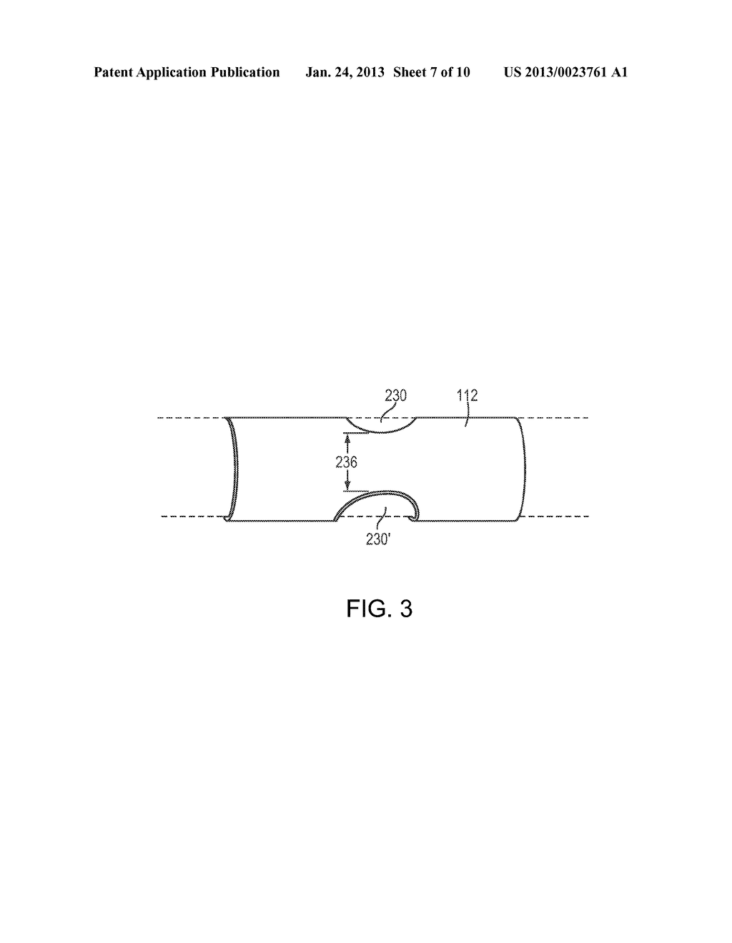 Torque Limiter for an OCT Catheter - diagram, schematic, and image 08