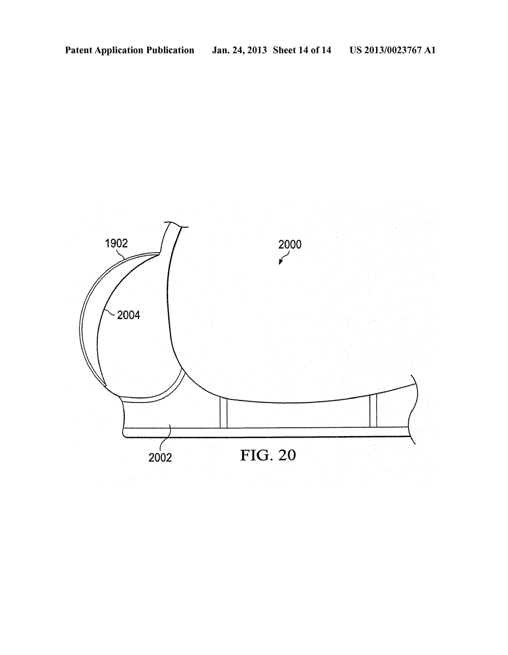 LOW-COST, HIGH FIDELITY ULTRASOUND SYSTEM - diagram, schematic, and image 15