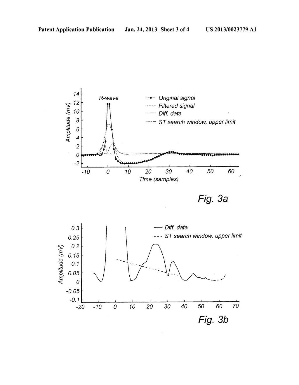 Method and System for Ischemia Detection - diagram, schematic, and image 04