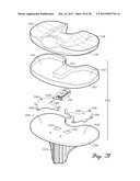 DISTRACTOR HAVING A CAPACITIVE SENSOR ARRAY FOR MEASURING A FORCE,     PRESSURE, OR LOAD APPLIED BY THE MUSCULAR-SKELETAL SYSTEM AND METHOD     THEREFOR diagram and image