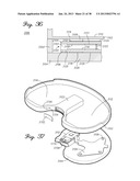 DISTRACTOR HAVING A CAPACITIVE SENSOR ARRAY FOR MEASURING A FORCE,     PRESSURE, OR LOAD APPLIED BY THE MUSCULAR-SKELETAL SYSTEM AND METHOD     THEREFOR diagram and image