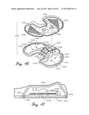 DISTRACTOR HAVING A CAPACITIVE SENSOR ARRAY FOR MEASURING A FORCE,     PRESSURE, OR LOAD APPLIED BY THE MUSCULAR-SKELETAL SYSTEM AND METHOD     THEREFOR diagram and image