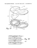 DISTRACTOR HAVING AN INTERNAL LOAD MEASURMENT SYSTEM FOR THE     MUSCULAR-SKELETAL SYSTEM AND METHOD THEREFOR diagram and image