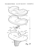 DISTRACTOR HAVING AN INTERNAL LOAD MEASURMENT SYSTEM FOR THE     MUSCULAR-SKELETAL SYSTEM AND METHOD THEREFOR diagram and image