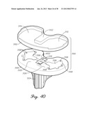 DISTRACTOR HAVING AN INTERNAL LOAD MEASURMENT SYSTEM FOR THE     MUSCULAR-SKELETAL SYSTEM AND METHOD THEREFOR diagram and image