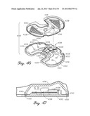 DISTRACTOR HAVING AN INTERNAL LOAD MEASURMENT SYSTEM FOR THE     MUSCULAR-SKELETAL SYSTEM AND METHOD THEREFOR diagram and image