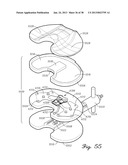 DISTRACTOR HAVING AN INTERNAL LOAD MEASURMENT SYSTEM FOR THE     MUSCULAR-SKELETAL SYSTEM AND METHOD THEREFOR diagram and image