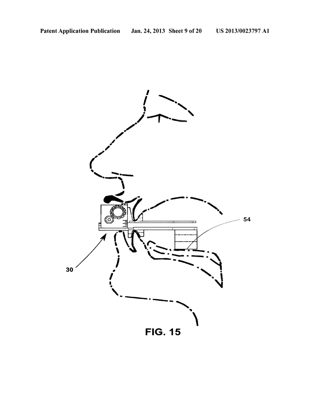 MANDIBULAR MANIPULATOR AND RELATED METHODS - diagram, schematic, and image 10