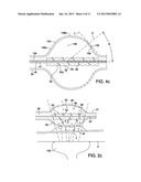 APPARATUS AND METHOD FOR DESTRUCTION OF VASCULAR THROMBUS diagram and image