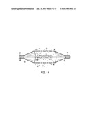 APPARATUS AND METHOD FOR DESTRUCTION OF VASCULAR THROMBUS diagram and image