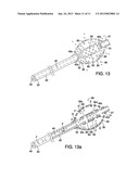 APPARATUS AND METHOD FOR DESTRUCTION OF VASCULAR THROMBUS diagram and image