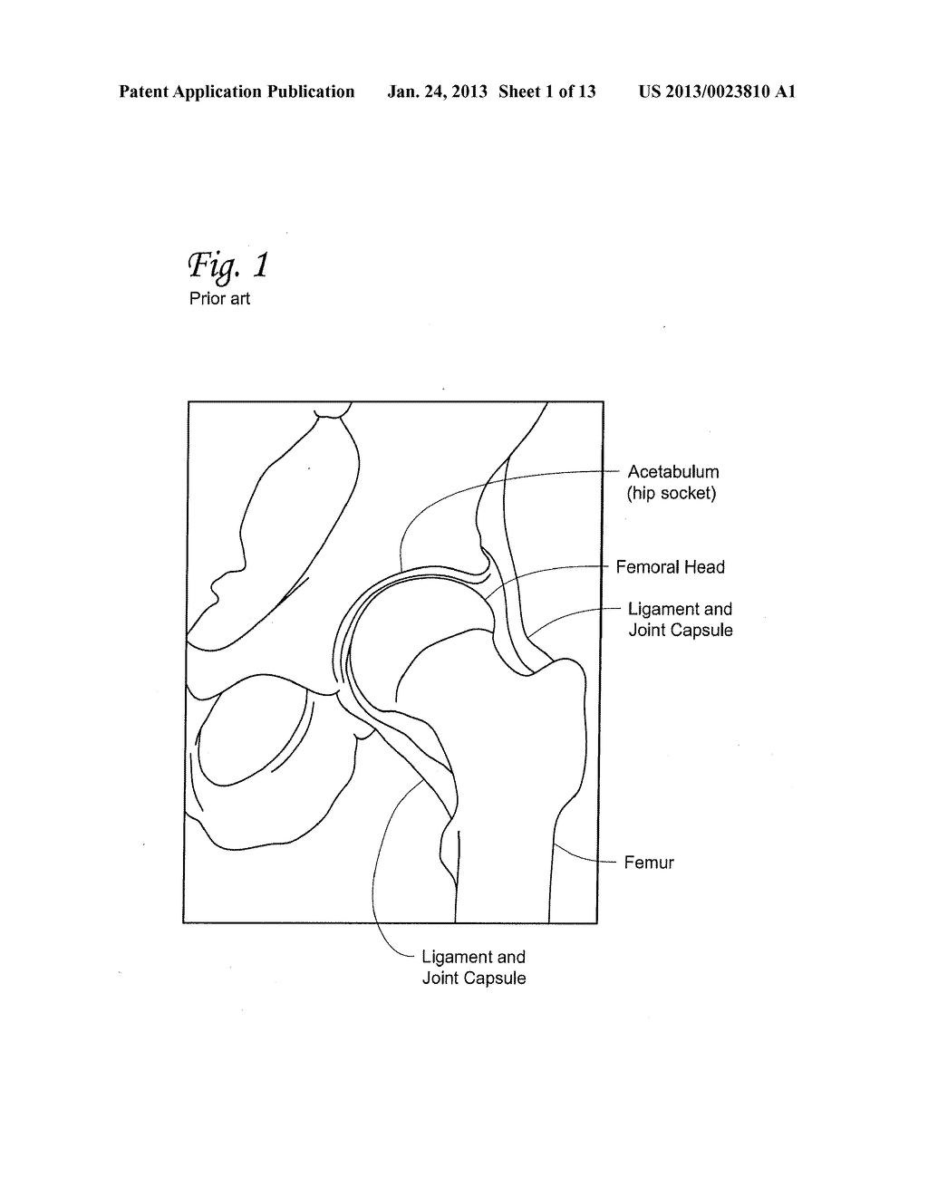 INFANT HIP JOINT POSITIONING DEVICE AND ASSOCIATED METHODS - diagram, schematic, and image 02
