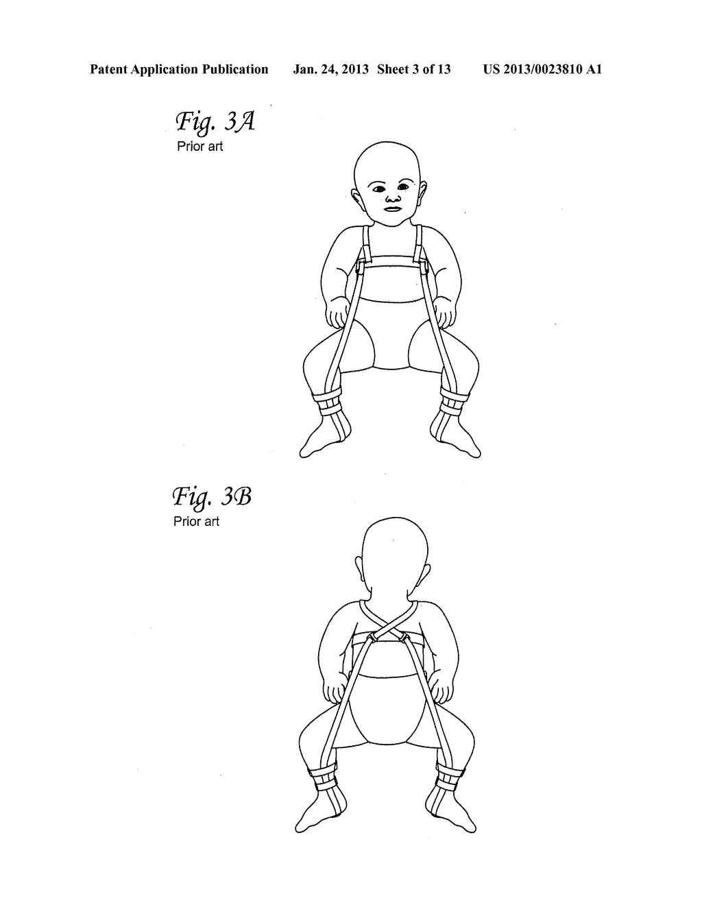 INFANT HIP JOINT POSITIONING DEVICE AND ASSOCIATED METHODS - diagram, schematic, and image 04