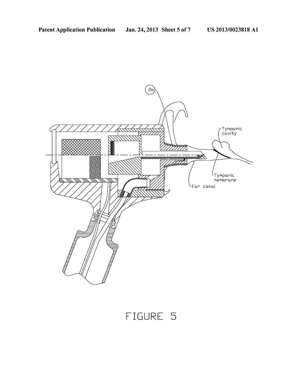 DEVICE AND METHOD FOR DELIVERING MEDICINE INTO THE TYMPANIC CAVITY,WITH     SLIDING ASSIST - diagram, schematic, and image 06