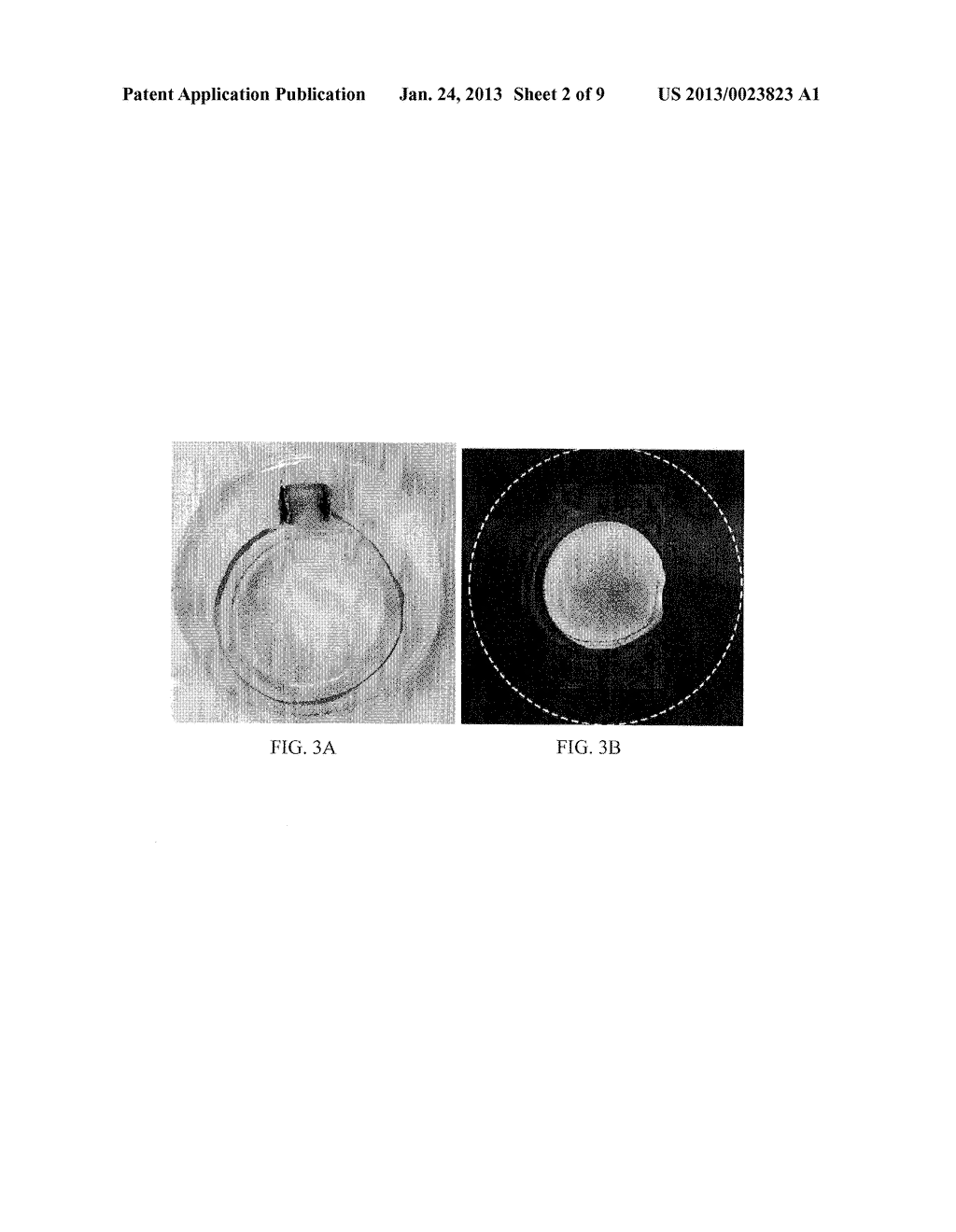 IMPLANTABLE THERAPEUTIC DEVICE AND METHODS OF MAKING - diagram, schematic, and image 03