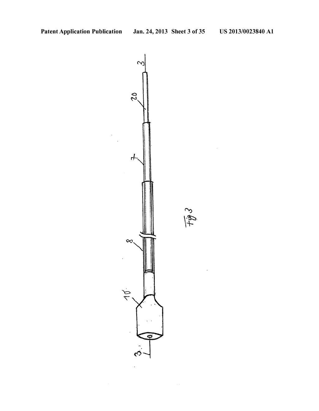 Vacuum Sponge Drainage - diagram, schematic, and image 04