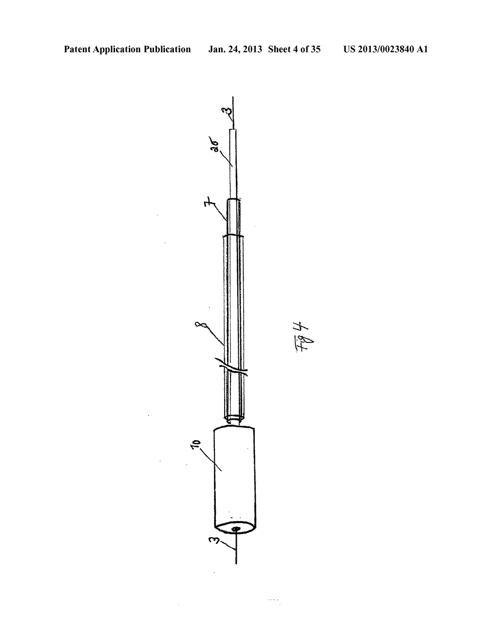 Vacuum Sponge Drainage - diagram, schematic, and image 05