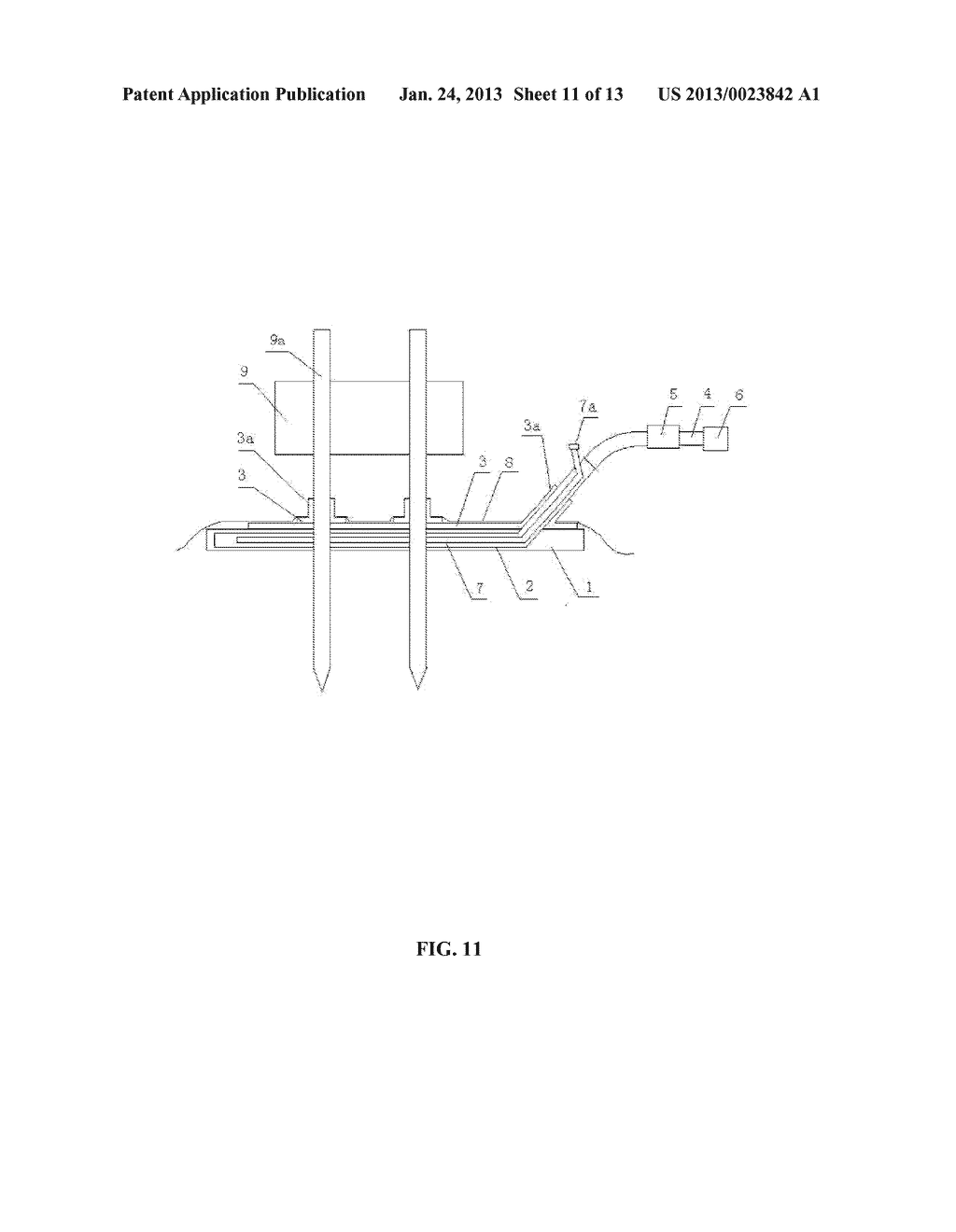 MEDICAL VACUUM SEALING DRAINAGE DEVICE - diagram, schematic, and image 12