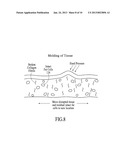 THERMALLY MEDIATED TISSUE MOLDING diagram and image