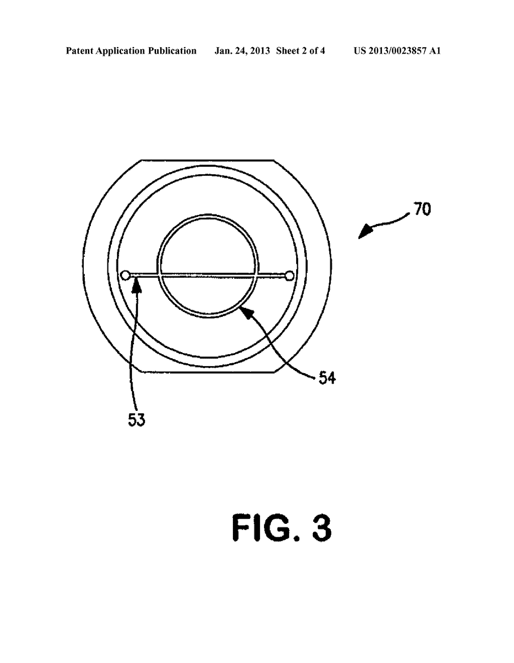 TWO WAY ACCUMULATOR PROGRAMMABLE VALVE PUMP - diagram, schematic, and image 03