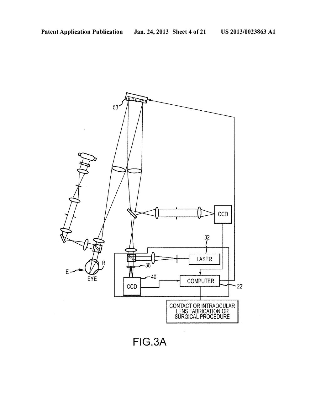 TILT COMPENSATION, MEASUREMENT, AND ASSOCIATED ADJUSTMENT OF REFRACTIVE     PRESCRIPTIONS DURING SURGICAL AND OTHER TREATMENTS OF THE EYE - diagram, schematic, and image 05