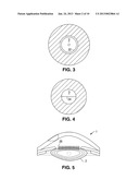 METHOD AND APPARATUS FOR PATTERNED PLASMA-MEDIATED LASER TREPHINATION OF     THE LENS CAPSULE AND THREE DIMENSIONAL PHACO-SEGMENTATION diagram and image