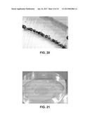 METHOD AND APPARATUS FOR PATTERNED PLASMA-MEDIATED LASER TREPHINATION OF     THE LENS CAPSULE AND THREE DIMENSIONAL PHACO-SEGMENTATION diagram and image