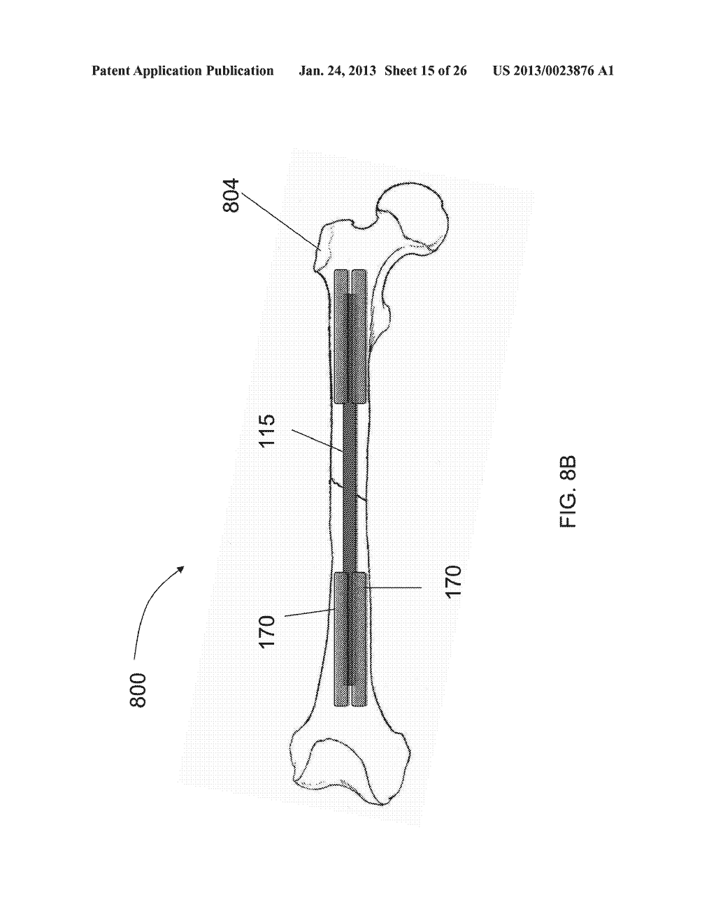 Combination Photodynamic Devices - diagram, schematic, and image 16