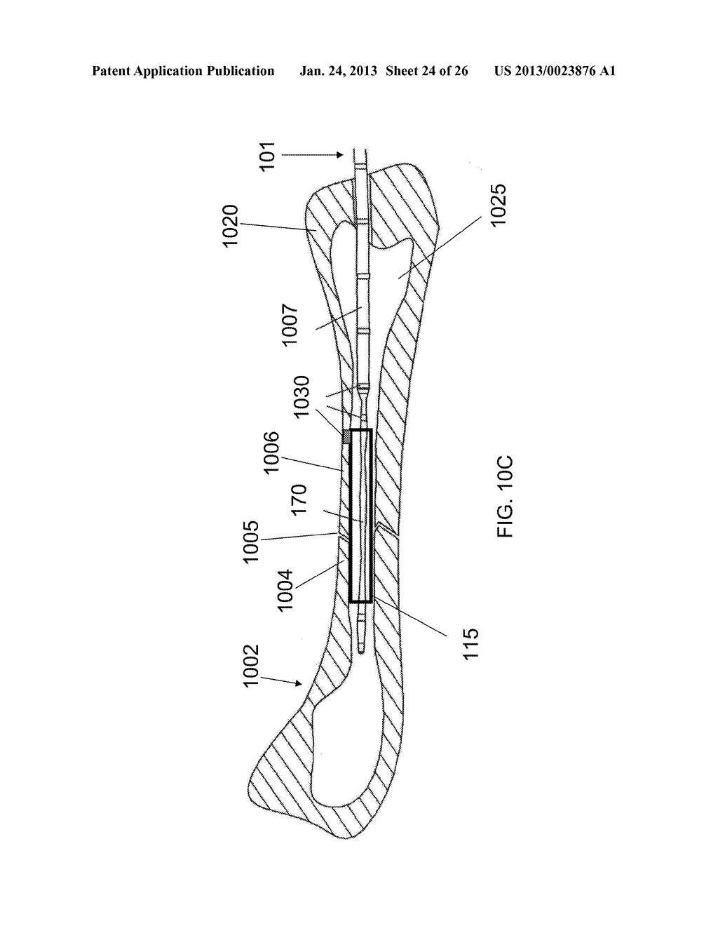 Combination Photodynamic Devices - diagram, schematic, and image 25