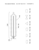 PHOTODYNAMIC BONE STABILIZATION SYSTEMS AND METHODS FOR REINFORCING BONE diagram and image