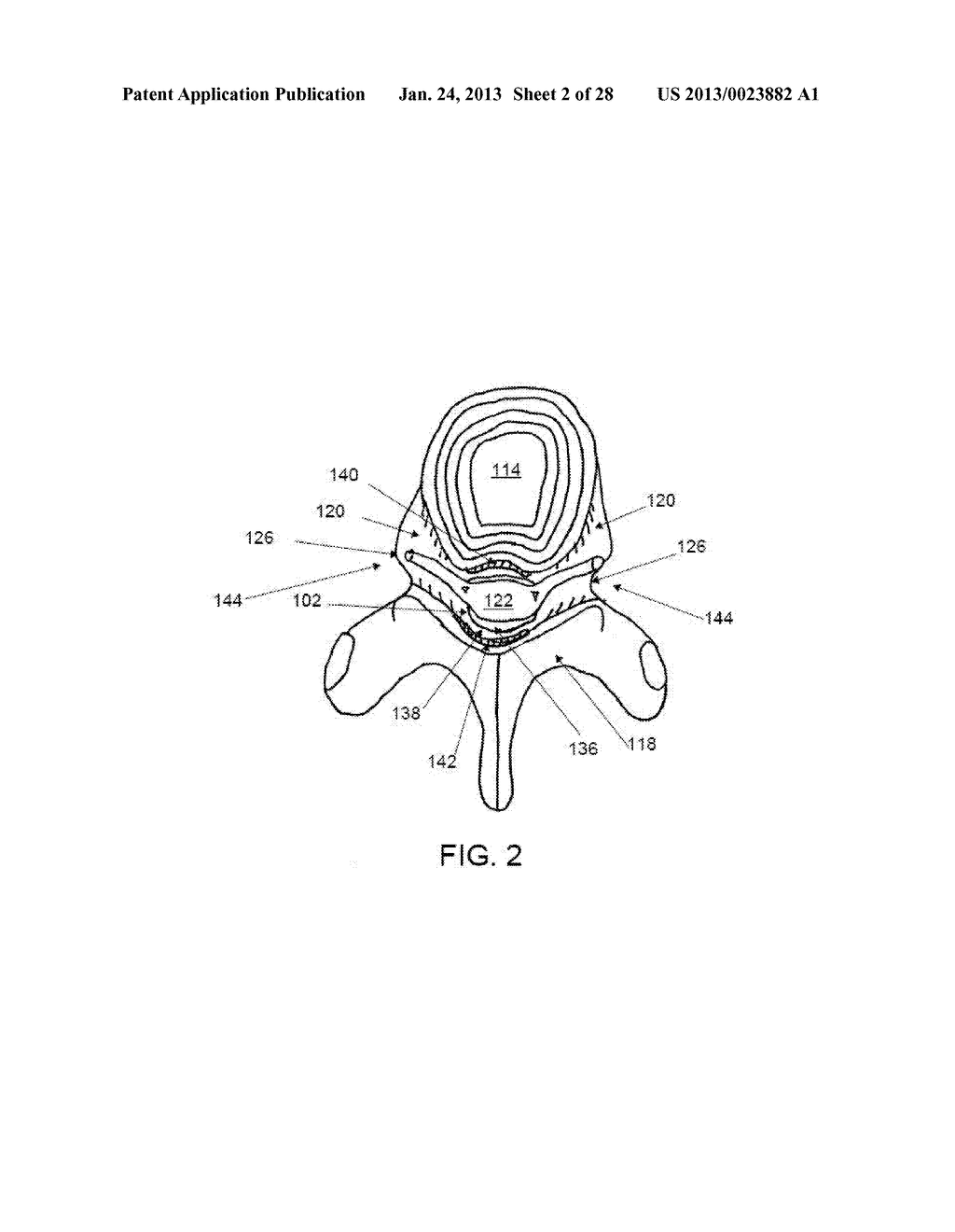 DISCECTOMY DEVICES AND RELATED METHODS - diagram, schematic, and image 03