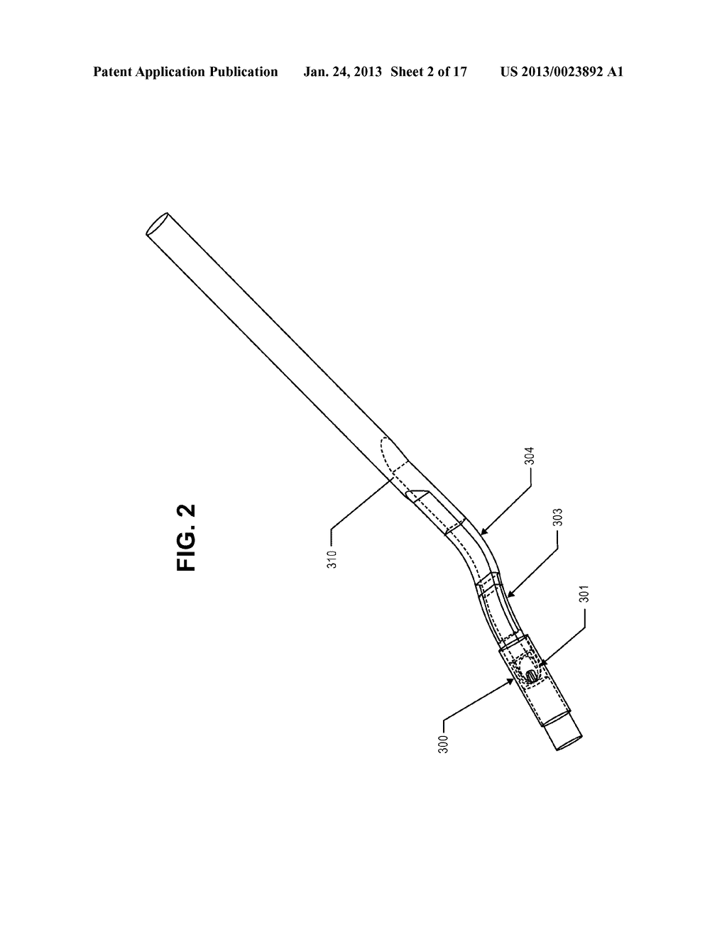 Corneal Implant Retaining Devices and Methods of Use - diagram, schematic, and image 03