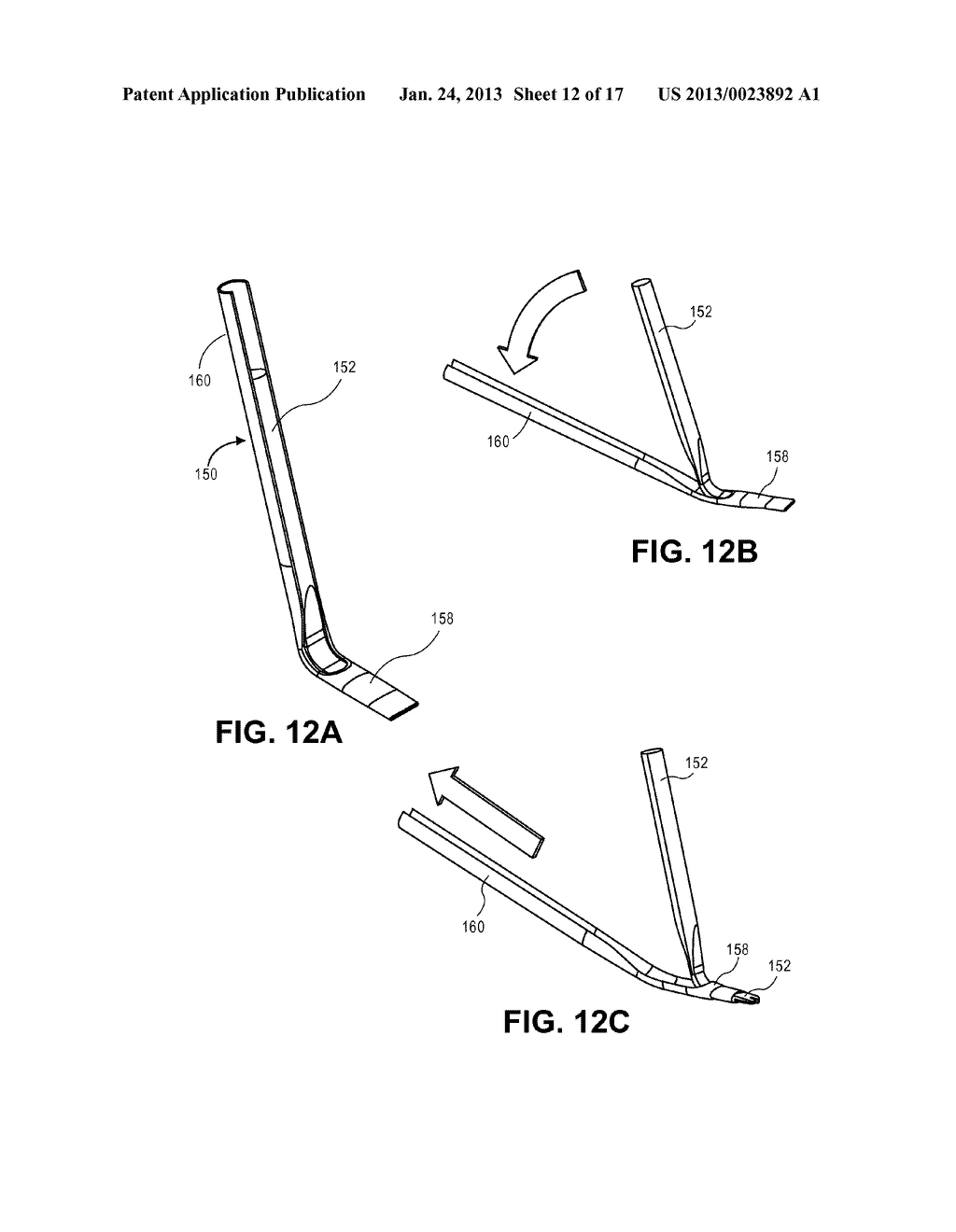 Corneal Implant Retaining Devices and Methods of Use - diagram, schematic, and image 13