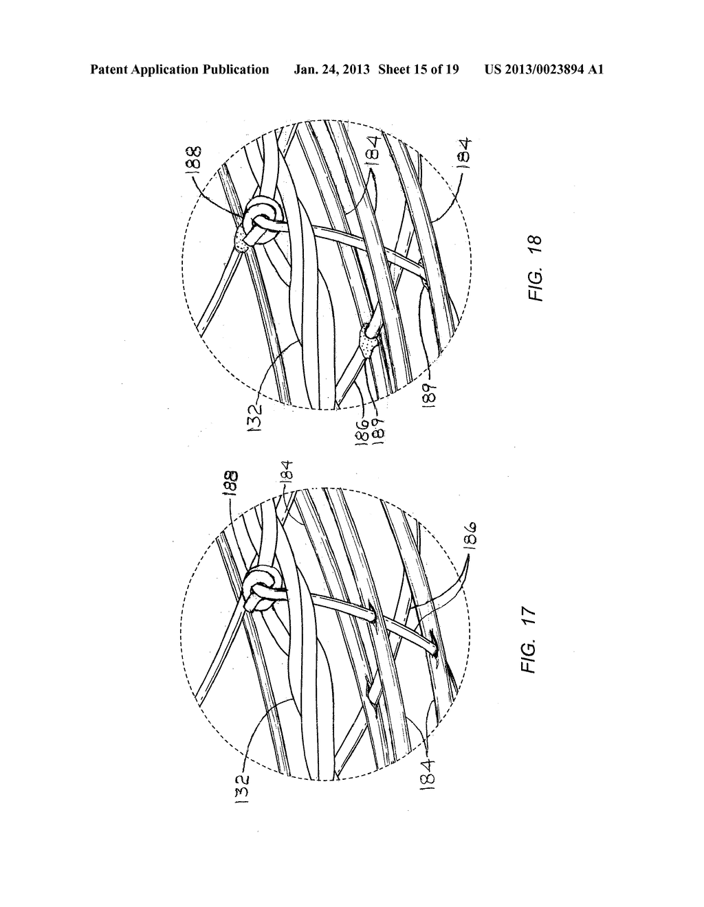 SURGICAL RETRIEVAL APPARATUS AND METHOD WITH SEMI-RIGIDLY EXTENDABLE AND     COLLAPSABLE BASKET - diagram, schematic, and image 16