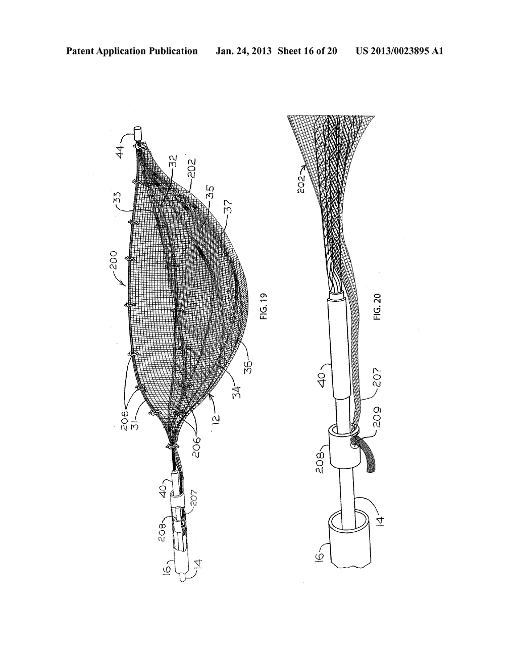 SURGICAL RETRIEVAL APPARATUS AND METHOD WITH SEMI-RIGIDLY EXTENDABLE AND     COLLAPSABLE BASKET - diagram, schematic, and image 17